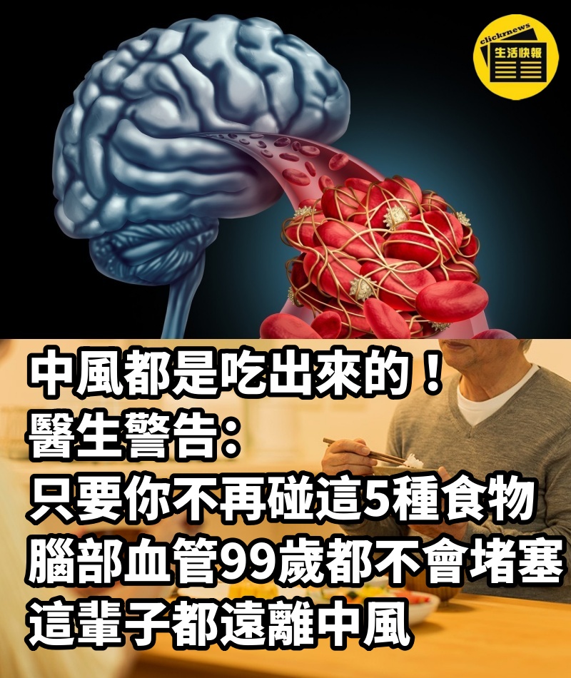 中風都是吃出來的 ！醫生警告：只要你不再碰這5種食物，腦部血管99歲都不會堵塞，這輩子都遠離中風